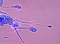 Irmãos Brant - Micotoxinas em dietas para bovinos leiteiros: quais sao os limites?